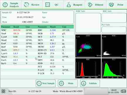 WML-420D 5-diff Auto Hematology Analyzer